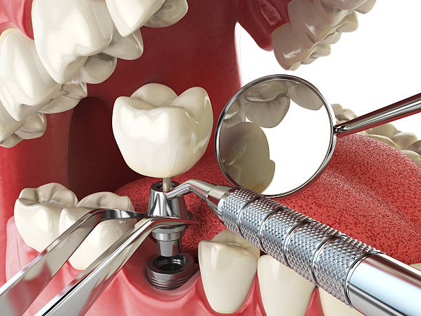 Best Same-Day Emergency Dental Services in Renovo, PA